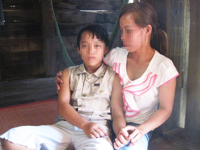 Bé gái 11 tuổi có 2 bộ phận sinh dục ở Đắk Nông