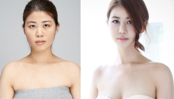 Cô gái Hàn thành hot girl sau khi phẫu thuật mặt và bộ ngực chảy xệ 23cm