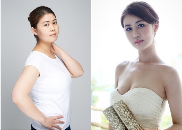 Cô gái Hàn thành hot girl sau khi phẫu thuật mặt và bộ ngực chảy xệ 23cm