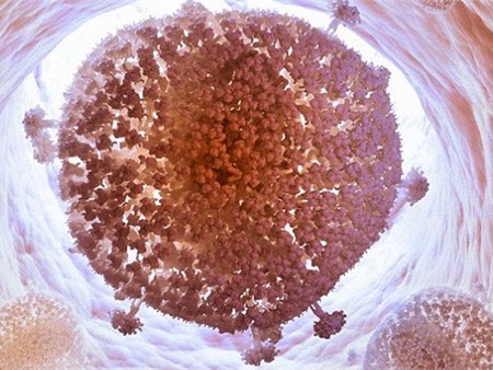 Loại bỏ thành công virút HIV khỏi tế bào người