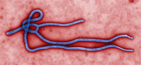   Đại dịch đang đe doạ thế giới  -  Mọi điều cần biết về Ebola