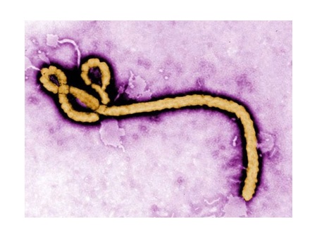 Ebola có lây qua đường 'ân ái'?