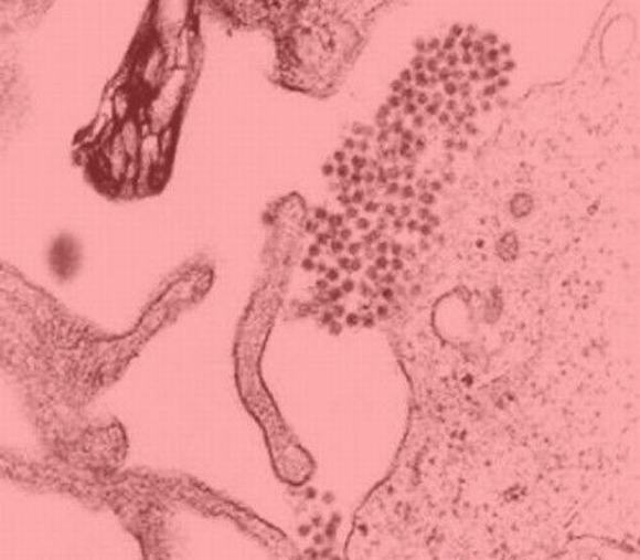 10 loại virus chết người nguy hiểm nhất thế giới