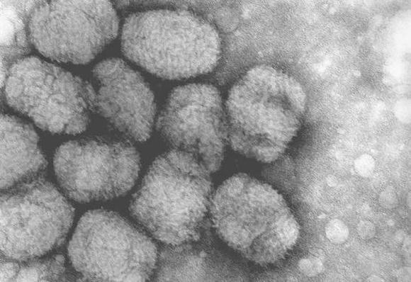 10 loại virus chết người nguy hiểm nhất thế giới