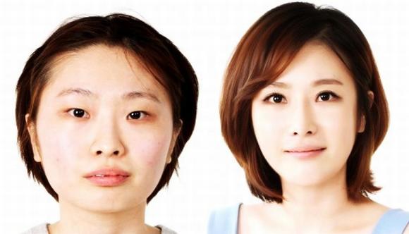Những ca phẫu thuật thẩm mỹ đáng kinh ngạc nhất xứ Hàn