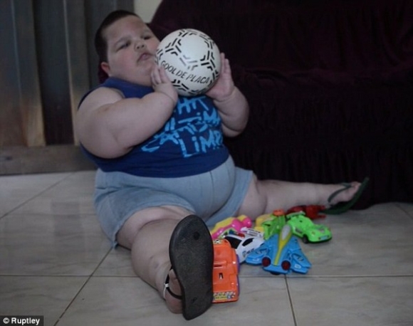 Bé trai mới 3 tuổi đã nặng 70kg do mắc bệnh không thể ngừng ăn