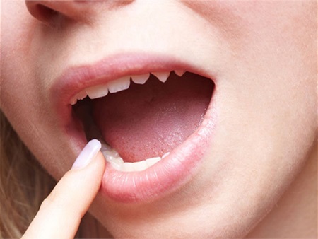 Màu sắc của lưỡi tiết lộ gì về sức khỏe?