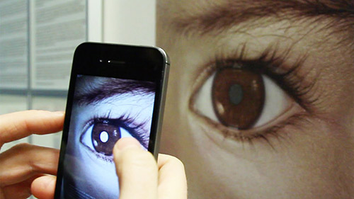 Bố Việt cảnh báo cha mẹ kiểm tra ung thư mắt trẻ bằng iphone