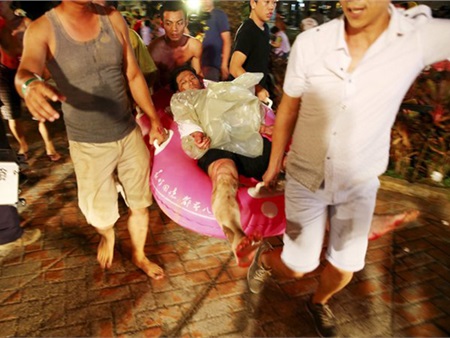 Kinh hoàng: vụ nổ ở Đài Loan Nạn nhân bị bỏng đến mức 'lột da'