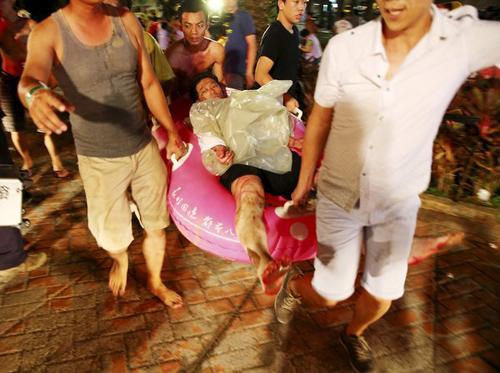 Nạn nhân vụ nổ ở Đài Loan bị bỏng đến mức 'lột da'