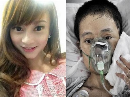 Cô gái xinh đẹp suýt chết vì mặt bị 'phá hủy' bởi hơn 200 con giòi