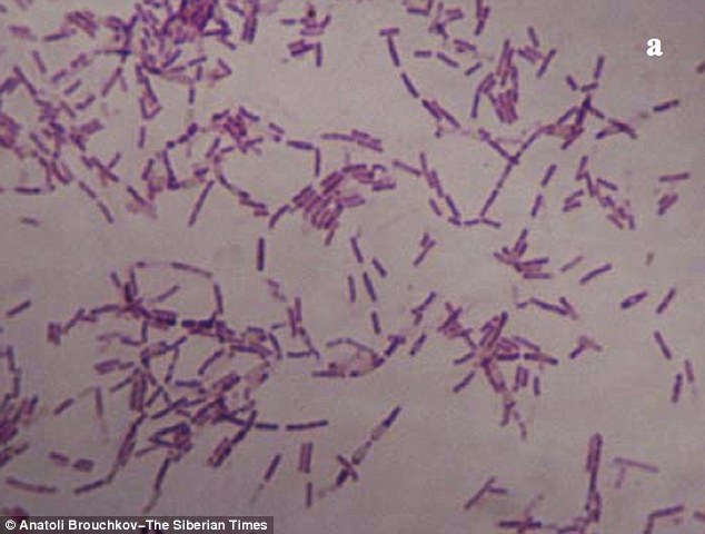 Phát hiện loại vi khuẩn giúp con người "trường sinh"?